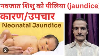 Neonatal jaundice navjat shishu ka jaundice Physiological jaundice [upl. by Marget]