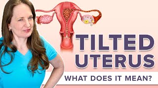 Is It Harder To Conceive With Retroverted Uterus  Dr Lora Shahine [upl. by Agretha365]