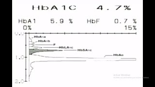 les techniques de dosage Technique HPLC pour dosage HBA1c [upl. by Leifer]