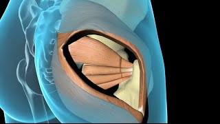 Total Hip Replacement [upl. by Schindler]