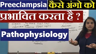 Preeclampsia Pathophysiology in Hindi हिंदी  Pregnancy induced Hypertension  Nursing Lecture [upl. by Bethel11]