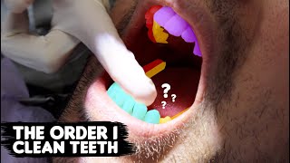 The Order I Clean My Patients Teeth My Scaling Sequence [upl. by Katt]