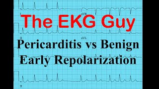 EKGECG  Pericarditis vs Benign Early Repolarization  The EKG Guy  wwwekgmd [upl. by Bekki720]