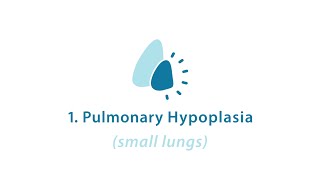 CDH Part 2 CDH Pulmonary Hypoplasia [upl. by Naltiac]