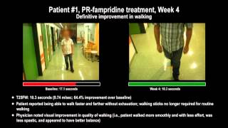 Assessing the clinical benefit of PRfampridine  Supplementary video patient 1 42957 [upl. by Launamme58]