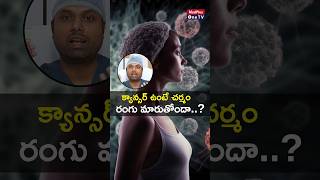 Skin Color Changes A Cancer Symptom l Dr Pavan Kumar Jonnada shorts MedPlusONETV [upl. by Adnuhser157]