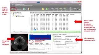 Tutorial n1 Importazione dei file dicom in coDiagnostiX [upl. by Dion]