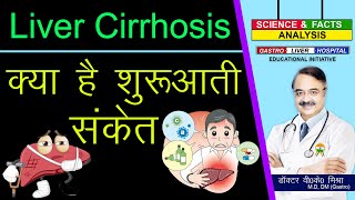 Liver Cirrhosis क्या है शुरुआती संकेत   CIRRHOSIS OF LIVER [upl. by Eelorac]