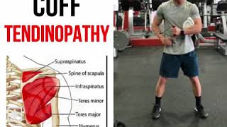 Rotator Cuff Tendinopathy [upl. by Nelo]