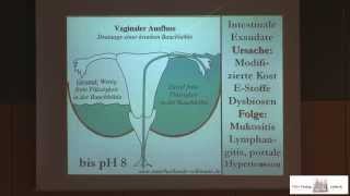 Ausfluss aus der Scheide  Ursachen und Auswirkungen  Schleimhautentzündung und Krampfadern [upl. by Eniowtna419]