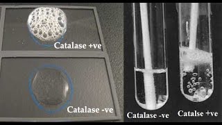 Microbiology catalase test [upl. by Labanna502]