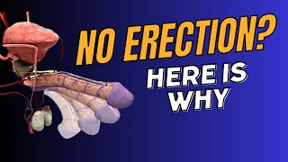 Unveiling the Mysteries of Not Having an Erection [upl. by Ynohtnaeoj]