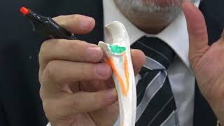 Practical osteology upper limb 7 Ulna  by Dr Wahdan [upl. by Airekat]