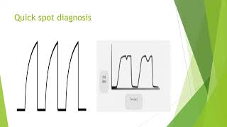 Capnography in Anaesthesia and Critical Care [upl. by Randa]