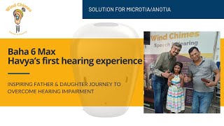 Baha 6 Max  Havyas First Hearing Experience [upl. by Schlosser]