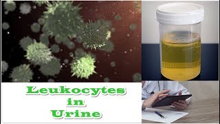 Leukocytes in Urine  No Nitrates [upl. by Sivra304]