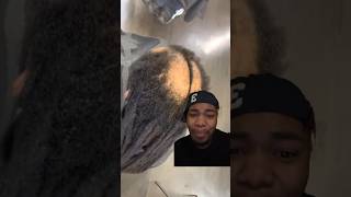 Bald Spot with Dreads is NASTY WORK 😂💀 [upl. by Ahsiekat]