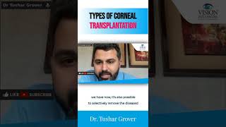 Types of Corneal Transplantation  Dr Tushar Grover [upl. by Akcired]