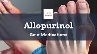 allopurinol  Uses Dosage Side Effects amp Mechanism  Aloprim [upl. by Enohpets]