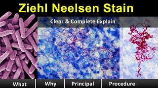 ziehl neelsen Stain  Clear amp Complete Overview [upl. by Aneehsal]