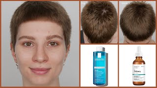 The Ordinary Hair Serum with La Roche Posay Kerium Extra Gentle Shampoo  9 Weeks Results [upl. by Weisman366]