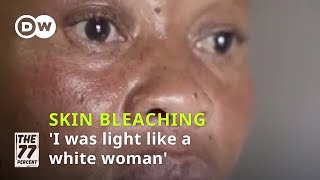 Skin bleaching The risks behind the beauty craze│DW The 77 Percent [upl. by Jarv289]