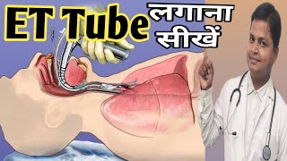 ET Tube Intubation How To Insert ET Tube drsubhashkumar [upl. by Rotman]