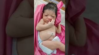 Newborn baby with a big caput due to obstructed labour📽️shortsshortsfeedshortvideotrendingbaby [upl. by Warden]