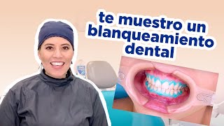 BLANQUEAMIENTO DENTAL  COMO LO HACEMOS [upl. by Dimitry465]