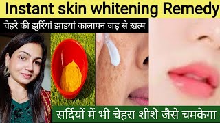 हफ्ते में सिर्फ 2 बार सर्दियों में भी चेहरा शीशे जैसे चमकेगा  Skin Brightening Remedy beauty tips [upl. by Liebowitz]