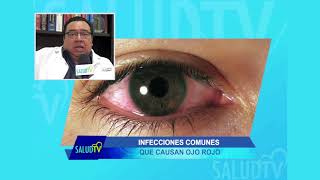 Causas infecciosas que puede ocasionar ojos rojos [upl. by Belding]