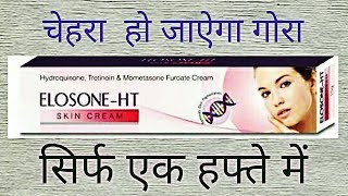 Elosone HT Cream Review Side Effects UsesBest Fairness Cream For Marks [upl. by Ecinad]