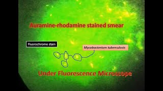 Auramine phenol stain Mycobacterium positveFluorescence microscope [upl. by Eenahc922]