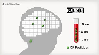 Little Things Matter The Impact of Toxins on the Developing Brain [upl. by Analos]