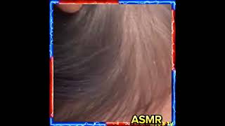 ASMR LICE REMOVE lice hair hairstyle liceremoval haircare [upl. by Salamone291]