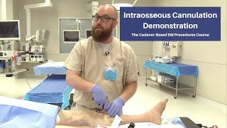 Intraosseous Cannulation Demonstration  The CadaverBased EM Procedures SelfStudy Course [upl. by Nevla]