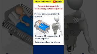 Sedation in ICU  Sedation in the Intensive Care Unit [upl. by Lexis]