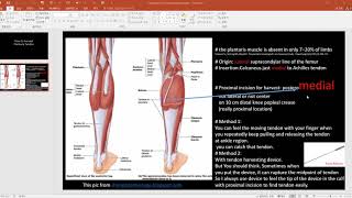 Harvest plantaris tendon [upl. by Skoorb]