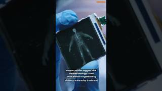 Nanotechnology in Medicine Miracle Cure or Hidden Danger medicalbreakthroughs medicaltechnology [upl. by Idelle845]