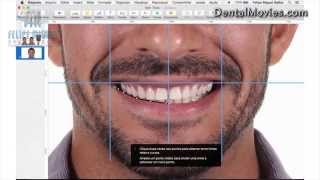 DSD  Digital Smile Design by Felipe Miguel [upl. by Thadeus]