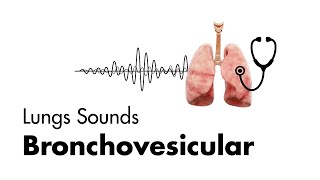 Bronchovesicular Breath Sounds  Lung Sounds  MEDZCOOL [upl. by Nelia]