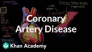 What is valvular heart disease  Circulatory System and Disease  NCLEXRN  Khan Academy [upl. by Rosene479]