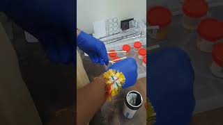 urinetest strip shorts lab video creator shortfeed viral medicalstudent labtechnicians [upl. by Mia]