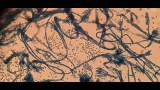 Food fungus under the Microscope [upl. by Sikram]