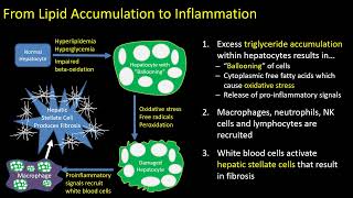 Hepatic Steatosis Part 1 Pathophysiology [upl. by Aernda527]