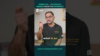 Umbilical vs incisional Hernia  Know the Difference  Mykare Health [upl. by Kerman461]