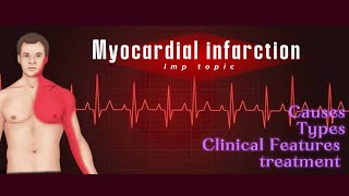 Myocardial infarction USMLE step 1usmle physiology medicines [upl. by Erdnaid]