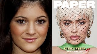 Kylie Jenner CONFESSES The TRUTH About Plastic Surgery amp Work Done On Her Face [upl. by Geraldine]