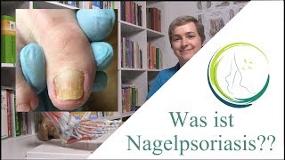 Haut trifft Nägel Psoriasis und ihre Auswirkungen im Detail mit podologinandrea [upl. by Melania]