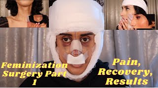 MTF Feminization Facial Surgery Part 1 graphic [upl. by Christian]